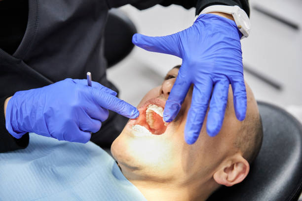 Best Emergency Dental Extractions in Butler, AL