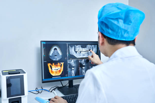 Best Emergency Dentist for Lost Fillings or Crowns in Butler, AL